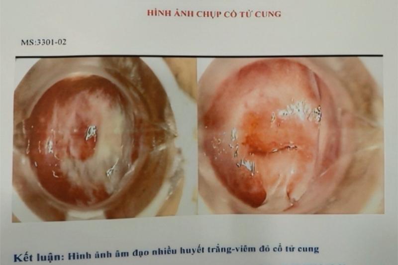 phong kham ve benh anh 1