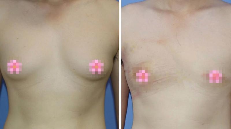 Phi dai tuyen vu anh 1