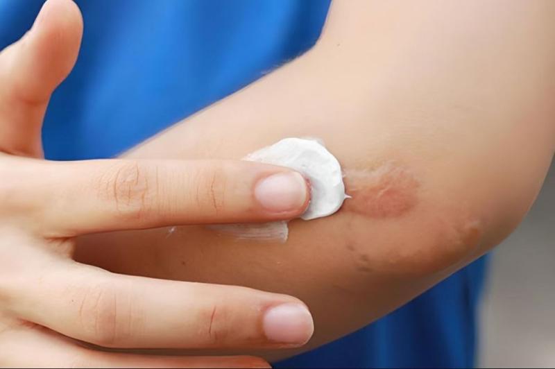 Thu hoi Gel Promed Starmed anh 1